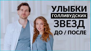 Улыбки звёзд ДО и ПОСЛЕ. Как делают голливудскую улыбку?