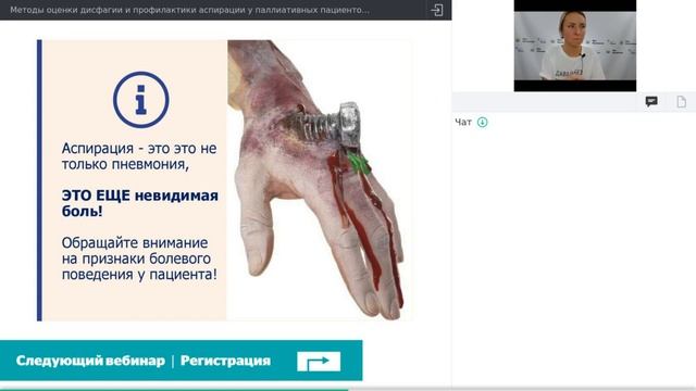 Методы оценки дисфагии и профилактики аспирации у паллиативных пациентов.