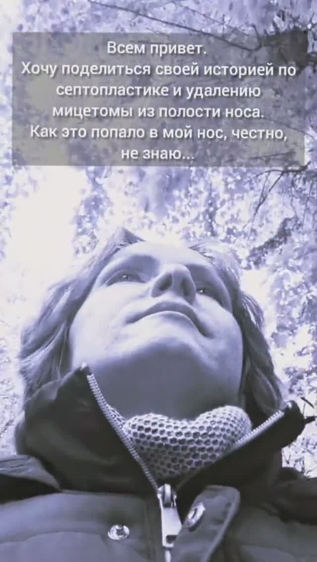 Отзыв пациента. Септопластика и удаление мицетомы из полости носа