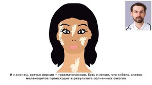 ВИТИЛИГО – ЧТО ЭТО ЗА БОЛЕЗНЬ. ПОЧЕМУ ВОЗНИКАЕТ ВИТИЛИГО? МОЖНО ЛИ ИЗЛЕЧИТЬСЯ ОТ ВИТИЛИГО?