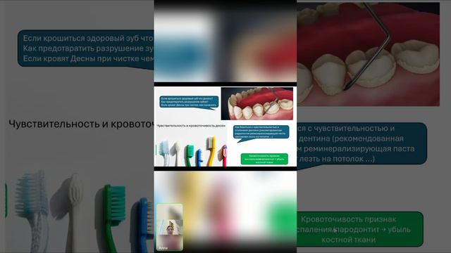08-04-2024  «Зубы : как сохранить, чего ожидать и опасаться после лучевой терапии».