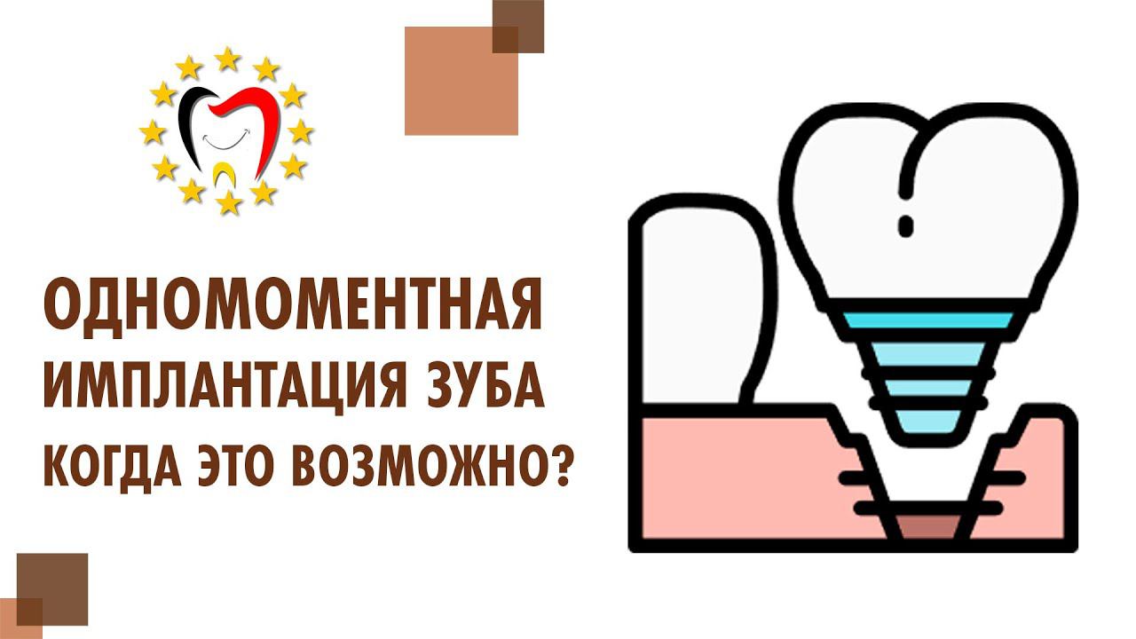 Имплантация зубов после удаления с немедленной нагрузкой. Имплантация зуба сразу после удаления.