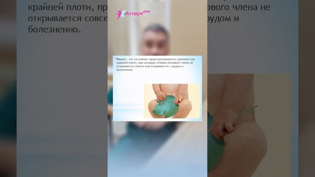 Баланопостит у детей:симптомы, причины, лечение и профилактика