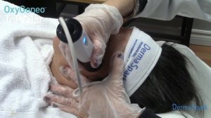 TriPollar hand piece on the OxyGeneo device - Training video by Katie Rietta, DermaSpark