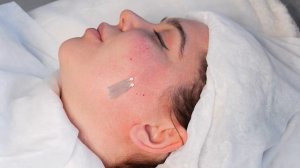 Постановка мезонитей