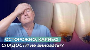 Осторожно, КАРИЕС! Почему СЛАДОСТИ не виноваты? Правда, которую НЕ РАССКАЖЕТ ни один стоматолог!