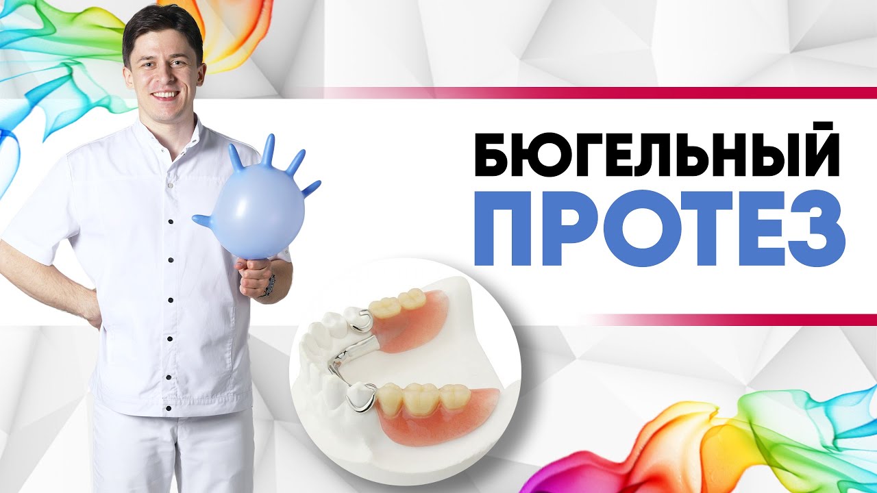 Бюгельный протез - это удобный съёмный кламмерный протез [ показания, преимущества, недостатки ].