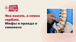 Ума палата, а спина горбата. Мифы и правда о сколиозе