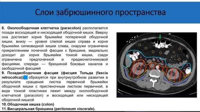 Топография органов забрюшинного пространства. СНО УРОЛОГИЯ УГМУ