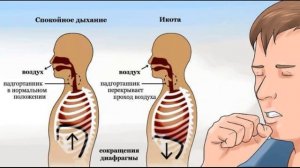 Заговор против икоты