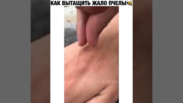 Как вытащить жало пчелы