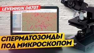 Лабораторный микроскоп LEVENHUK D870T С КАМЕРОЙ | Обзор и тест