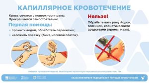 Оказание первой помощи при кровотечениях