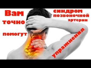 Синдром позвоночной артерии - упражнения, которые Вам помогут!