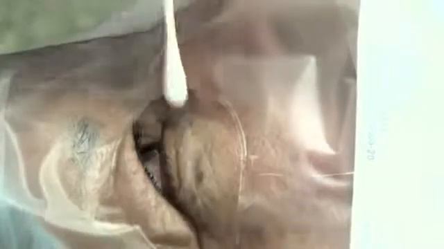 Удаление кератоза смотреть онлайн