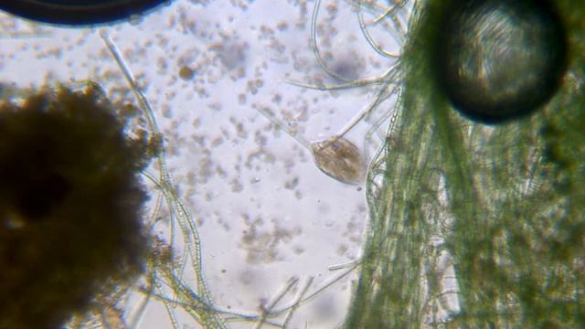 капля грязной воды под микроскопом смотреть онлайн