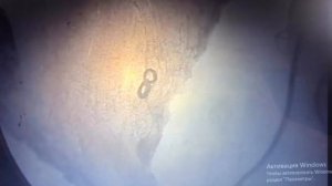 Послеубойная ветеринарно-санитарная экспертиза туши