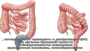 Причины и лечение энкопреза в детском возрасте