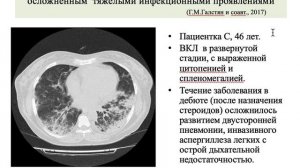 Альради Л.С. Волосатоклеточный лейкоз. Часть 2.