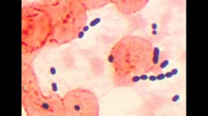 Энтерококки