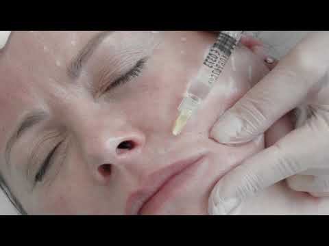 Mастер класс на препарате PLINEST Работа с отечно деформационным типом старения смотреть онлайн