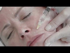 Mастер класс на препарате PLINEST  Работа с отечно деформационным типом старения