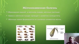 Заболевания органов пищеварения.mp4