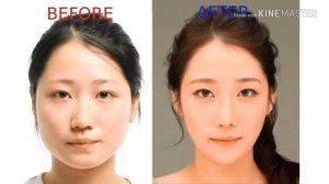 КОРЕЙЦЫ И КОРЕЯНКИ ДО И ПОСЛЕ ПЛАСТИКИ
