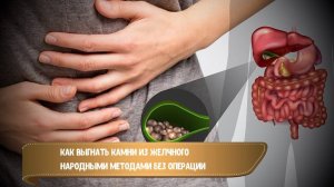 6 НАРОДНЫХ МЕТОДОВ ИЗГНАНИЯ ЖЕЛЧНЫХ КАМНЕЙ