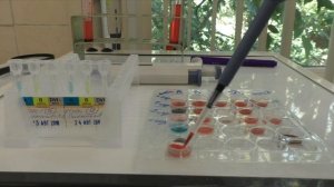 Холодовая агглютинация эритроцитов.