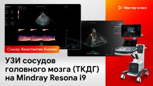 УЗИ сосудов головного мозга (ТКДГ) на Mindray Resona i9