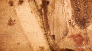 Почему умирают скалярии? Вздутие живота. Паразиты у рыбы. Рыбка заболела.