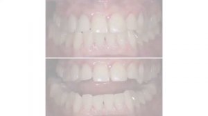 Часть три. Завершение работы. Новые зубы!