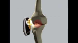 Аппарат магнитотерапии Physiomed Magcell