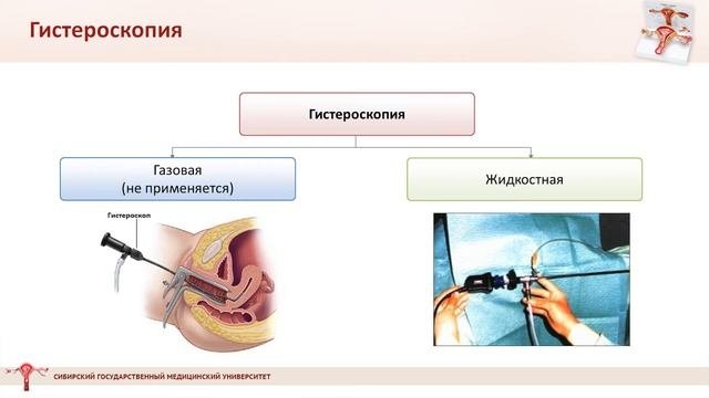 Ультразвуковой и эндоскопические методы диагностики в гинекологии
