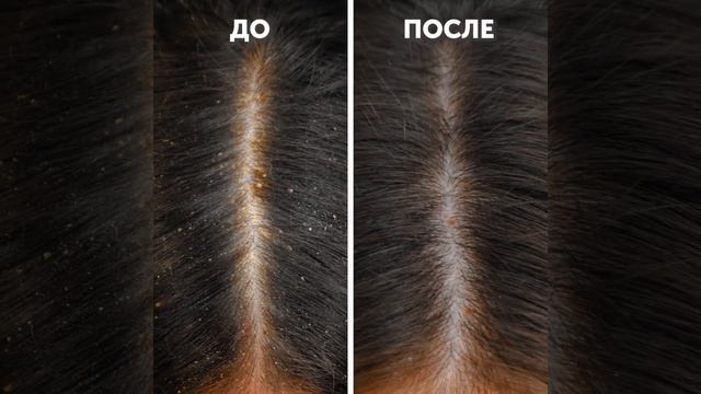 СУПЕР-ЛАЙФХАКИ КРАСОТЫ || КАК УХАЖИВАТЬ ЗА ПОДМЫШКАМИ