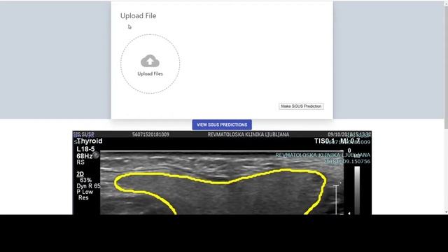React js image segmentation UI with Jersey REST execution engine executes DL tensorflow in Python3 смотреть онлайн