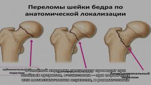 Рентген тазобедренного сустава в Москве