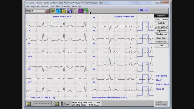 How to Print an ECG смотреть онлайн