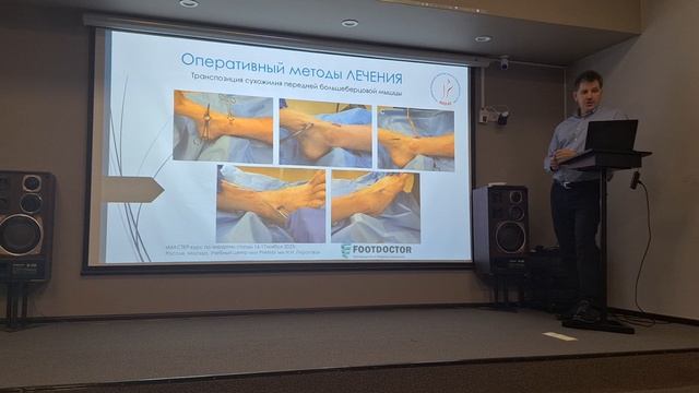 Анатомия стопы