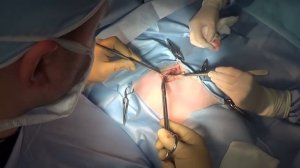 Хирургическое лечение хилоторакса у кошки