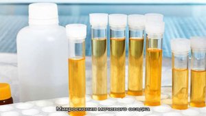 Микроскопия мочи