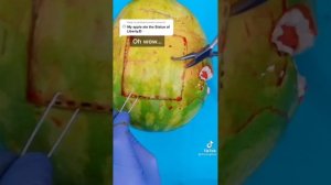 @fleetingfilms | Fruit & Vegetable Surgeries | Discount Dentist | TikTok Compilation