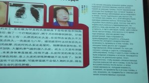 Воздействие холода на человеческое тело| Государственная корпорация Китая Новая Эра