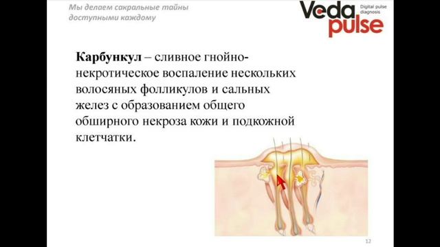 Гнойные заболевания кожи и подкожной клетчатки