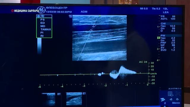 Телекөрсөтүү варикоз орусуна арналып, баардык маалыматтарды берет. смотреть онлайн