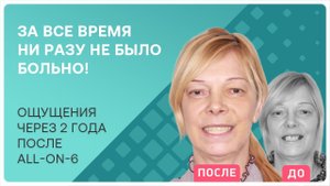 Все зубы all-on-6 ? ощущения 2 года спустя