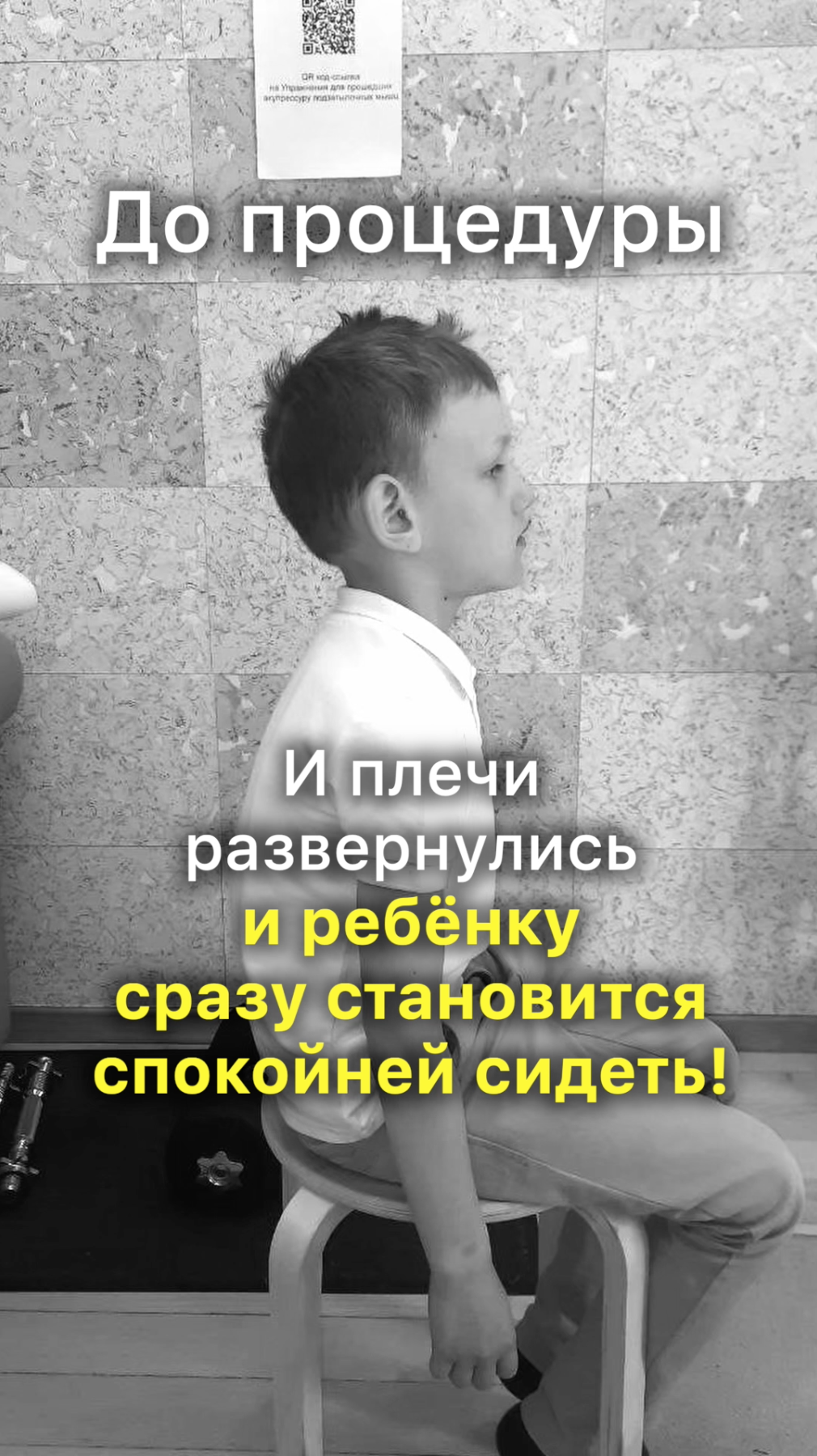 Ребёнок Сутулится? Главная причина! Как исправить сутулость у ребёнка. АКУПРЕССУРА - Россия. Отзыв