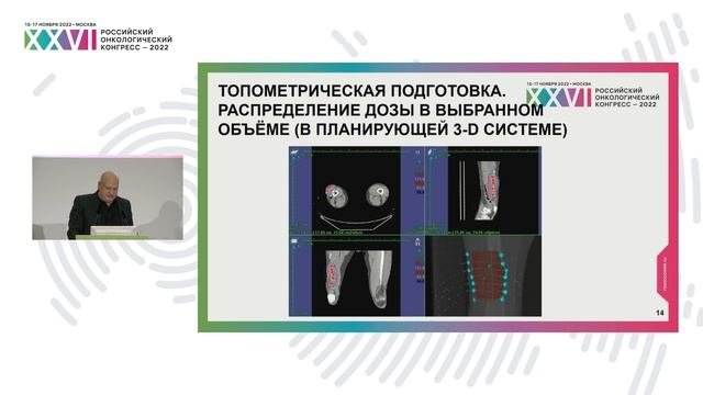 Роль брахитерапии в лечении сарком мягких тканей