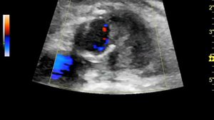 Диагностическая задача № 1 (для врачей ультразвуковой и функциональной диагностики)